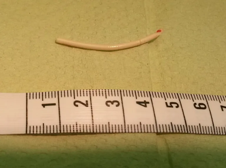 A contraceptive implant beside a ruler, showing its small size