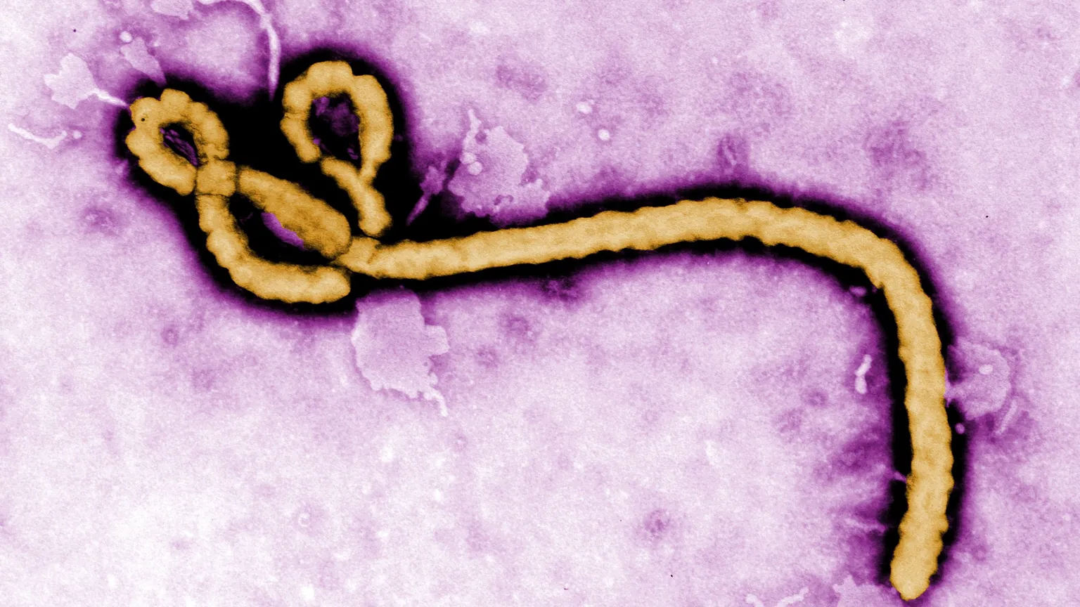 Archived image accompanying: DRC Ebola Outbreak Tops 1,100 Cases — Now the Largest Bundibugyo Outbreak on Record — as Virus Reaches Europe